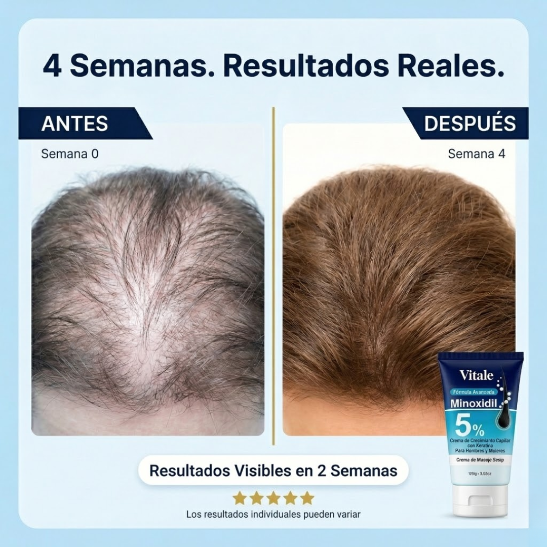 Vitale 5% Minoxidil & Keratina - Crema de Crecimiento Capilar  para Hombres y Mujeres