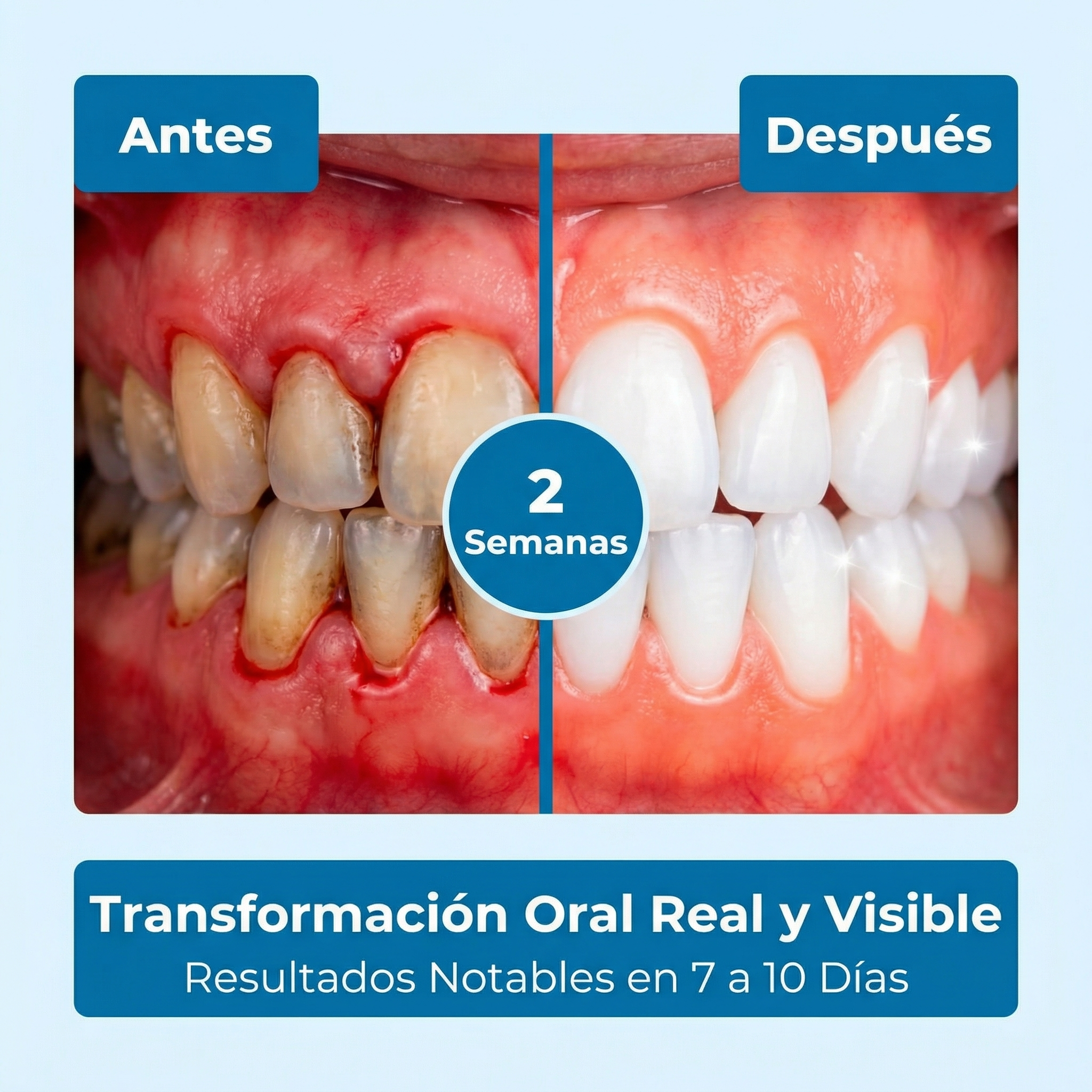 Vitale Spray Oral Natural para el Cuidado de Dientes y Encías
